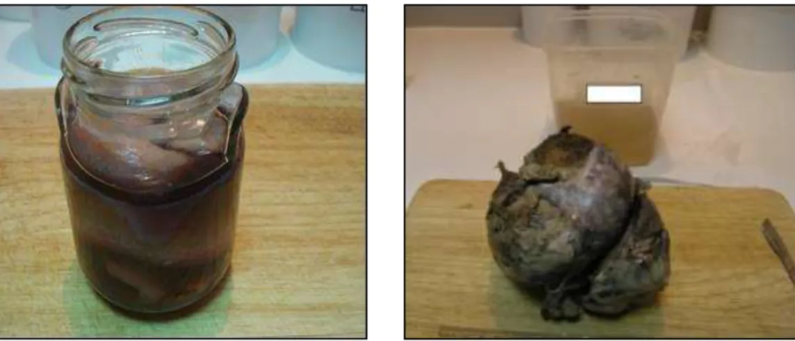 Figure  11.  Three  surgical  specimens  from  the  same  container  without  any  indication  of  the  corresponding  excision site (oriented from greater to smaler)