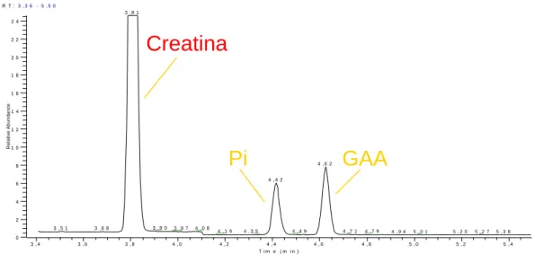 FIGURA 3 – Nova mutação no gene SLC6A8 