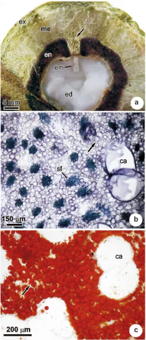 Figure 5  ‒  Transversal sections of the mature fruit of  A. 