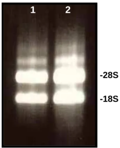 Figura 1: Eletroforese em gel de agarose 1% do RNA total de T. rubrum ATCC  52.021. 1: RNA extraído após cultivo em meio com queratina; 2: RNA extraído  após cultivo em meio sem queratina