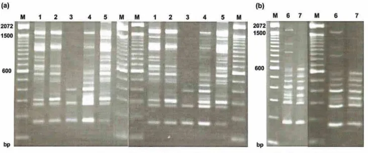 Fig. 4. (a) Comparison of RAPD patterns obtained using primer 1 trom clinical isolates of T