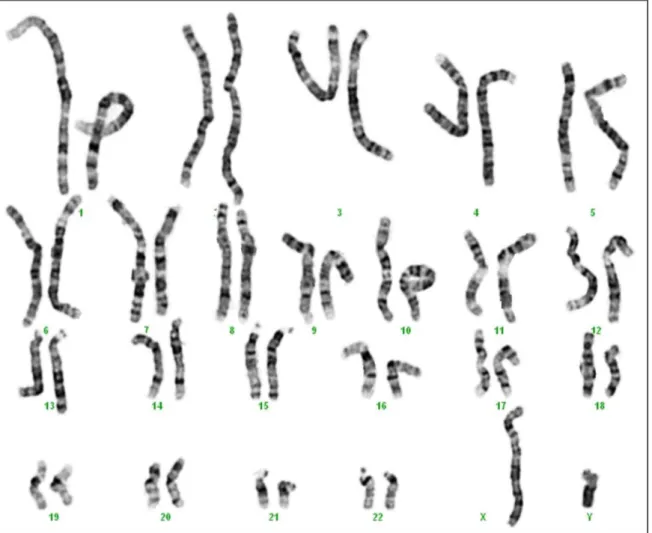 Figura  1.  Cariograma  humano  normal  com  cromossomas  de  alta  resolução  de  um  individuo  do  sexo  masculino,  46,  XY,  obtido  com  bandagem  GTG  (Imagem  cedida  pelo  LCG-FMUC)