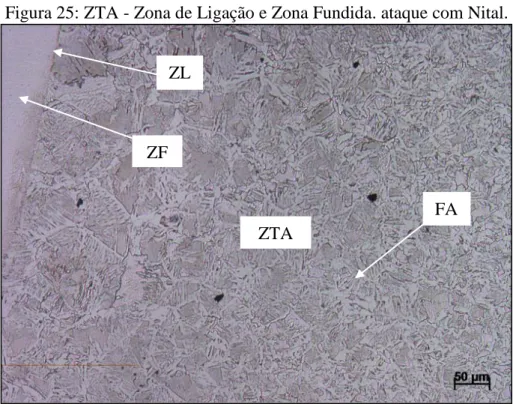 Figura 25: ZTA - Zona de Ligação e Zona Fundida. ataque com Nital. 
