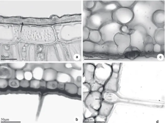 Figure 5 – Cross sections of Posoqueria Aublet leaf, details of epidermis – a. P. latifolia  with a thick cuticular layer (arrow);  b