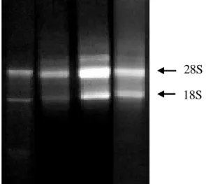 Figura  6.  Gel  agarose  a  1%  para  avaliar  a  integridade  do  RNA.  Duas  bandas  de  RNAs  ribossomais 28S (4,7 – 5 Kb) e 18S (1,95-2,1 Kb) são claramente visíveis e distintas (setas  à direita)