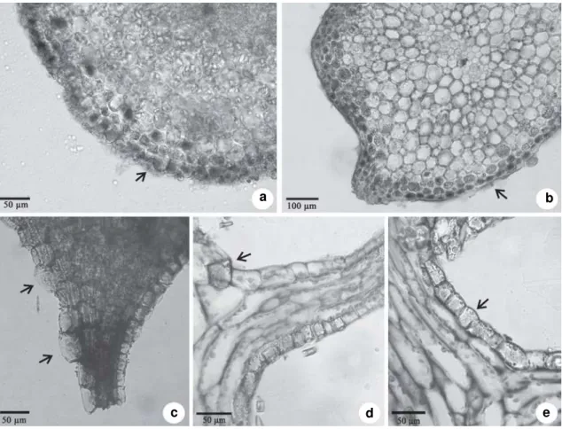 Figure 2 – a-e. Transversal (a-c) and longitudinal (d-e) sections of the vegetative body on light microscopy