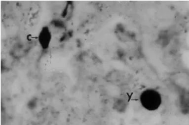 Fig. 1 - Presence of a conidium (C) and of a yeast cell (Y) in lung tissues, 24 h after inoculation with viable P