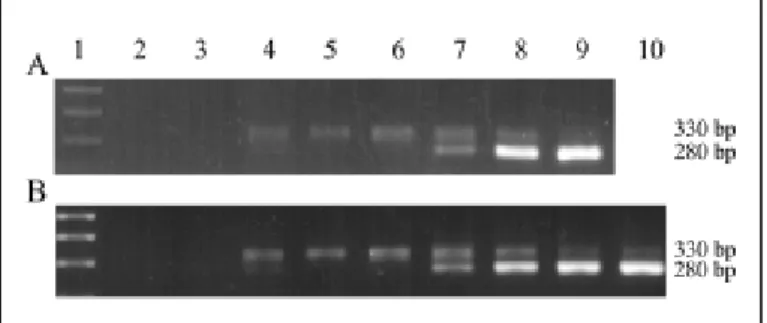 Fig. 4 - A: Quantitation of T. cruzi DNA by competitive PCR. Lane 1, 100 bp molecular weight marker; Lane 2, water; Lane 3, P388D1-IL1 DNA (negative control); Lane 4, T