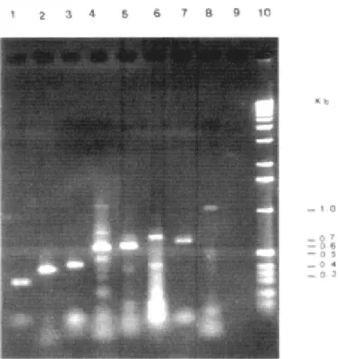 Fig. 1 - PCR products to different periodontopathogenic microorganisms using various primer pairs