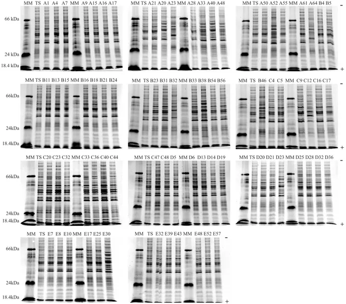 Fig. 1 - Electrophoregrams of whole-cell protein profiles from the seventy-five C. albicans strains isolated from healthy students’ oral cavities classified in five socioeconomic categories