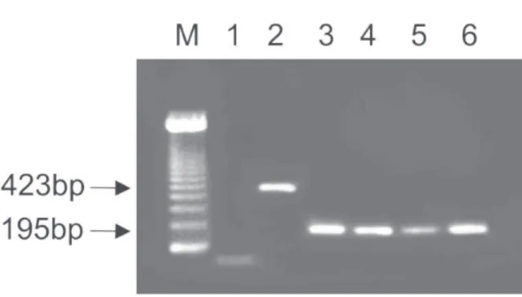 Fig. 2 - Agarose gel electrophoresis of nested PCR-amplified HHV-6 DNA of 6 serum samples, with variant-A (195 bp) and variant-B (423 bp) stained with ethidium bromide and photographed under U.V light