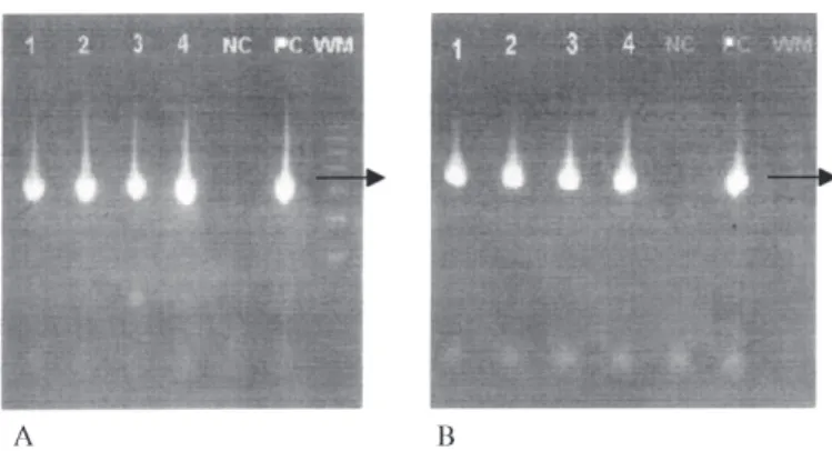 Figure 2 illustrates the results of the HO children, which showed a repetitive polymorphic pattern in 17 of the 30 analyzed samples characterized by the presence of two strong bands at the same positions in the gel