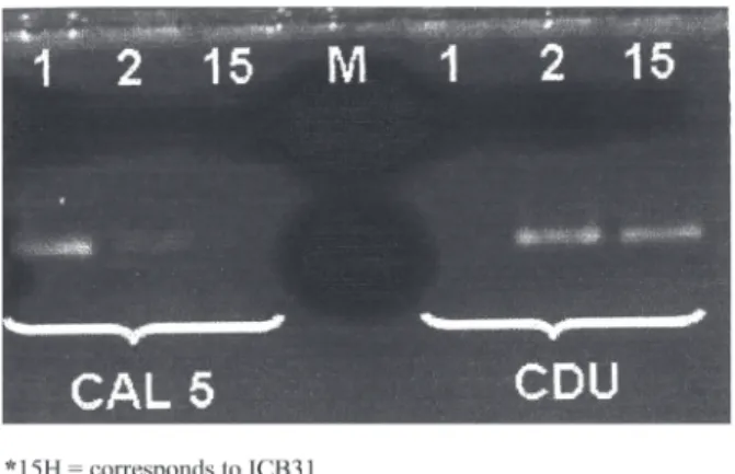 Fig. 1 - Electrophoretic analysis of the products obtained through the amplification of the genomic DNA of isolate 15 H and of the standards for Candida albicans (1) and Candida dubliniensis (2) using the primers CAL5 and NL4CAL, and CDU2 and NL4CAL.