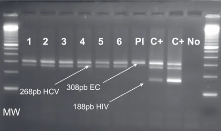 Fig. 2 - HCV-RNA Genotype Panel from NISBC comprising genotypes 1-6 (viral load not available) was submitted to the NAT assay.