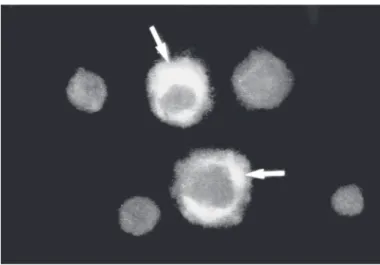 Fig. 1 - HSV-1 specific antigen revealed by indirect immunofluorescence in mouse corneal epithelium
