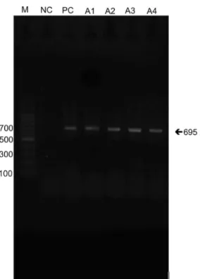 Fig. 2 - PCR amplification of Cryptococcus neoformans: M, 100 pb DNA ladder, 1 negative  control (NC), 1 positive control (PC) and sample isolates A1 (church), A2 (educational  institution), A3 (residence 1) and A4 (residence 2).