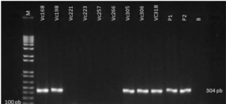Fig. 2 - Electrophoretic profile of nine strains identified genotypically as Vibrio cholerae  using primers for the species-specific gene OmpW (304 pb) on PCR.