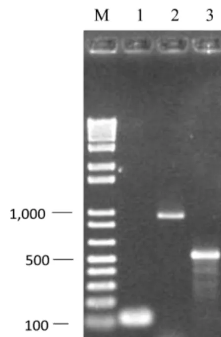 Fig. 1 - Amplification gel pictures characteristic of polymerase chain reaction (PCR)  amplification of Enterococcus sp gene
