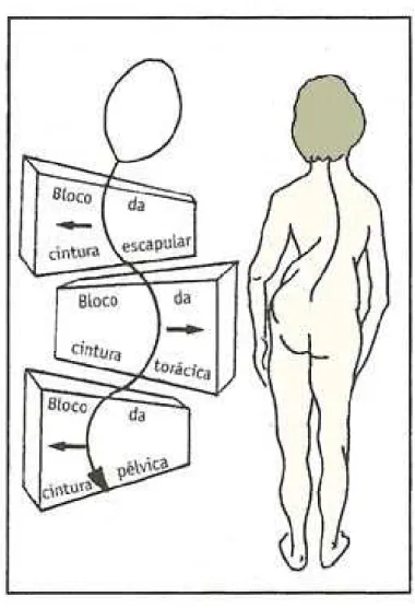 FIGURA 2.6 Figura esquemática do desalinhamento dos segmentos corporais em resposta à escoliose.