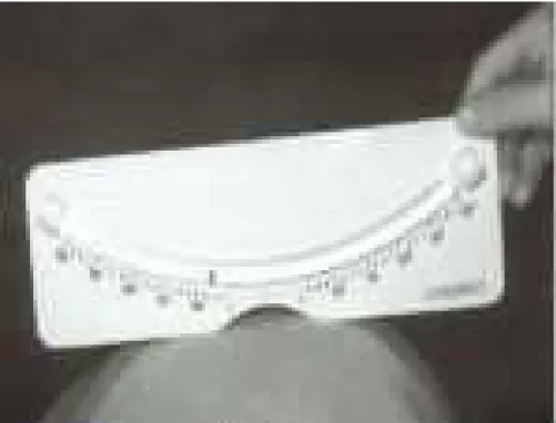 FIGURA 2.11 Escoliômetro dispositivo de medidas, em graus, no dorso do paciente para a curva escoliótica.