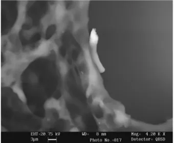 Fig. 2 - A scanning electron photomicrography from a pulmonary tissue of a BALB/c male  mouse, 30 minutes after intranasal inoculation with Paracoccidioides brasiliensis conidia.