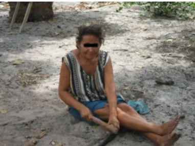 Fig. 4 - Babassu (Orbignya phalerata) nutcracker woman in the State of Maranhao, Brazil