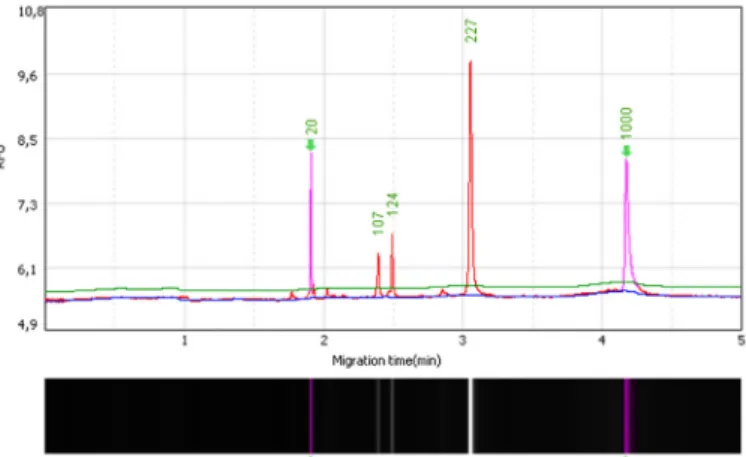 Fig. 1 - IL10 -3575 SNP (rs1800890) after RFLP. The heterozygous genotype (TA) generates  fragments of 227, 124, 107 bp