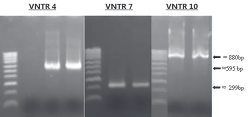 Figure 1 – Results obtained by VNTR assays with the AH2 human isolate corresponding to Leptospira interrogans Pomona Kennewicki