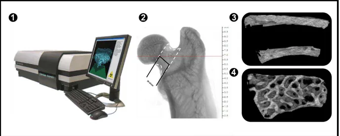 Figura  12.  ڤ  Microtomógrafo  Skyscan  1272  (Skyscan,  Aartselaar,  Bélgica)  para  análise  de  microtomografia  óssea  trabecular  e  cortical  ڥ  Imagem  representativa  do  posicionamento  crânio-caudal  do  fêmur  no  microtomógrafo ڦ  Imagem  de  