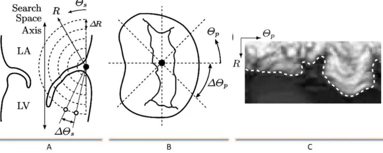 Figure 1.6: A) Search arc B) Atrial view of open valve C) Intensity image with trimming contour (adapted from [35])