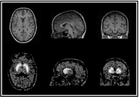 Figure  1.1.  Examples  of  medical  images  from  the  head,  transaxial,sagittal  and  coronal  views