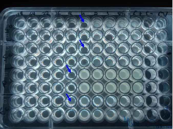 Figura 4: Microplaca com diluições referente ao teste em duplicata com bactérias aeróbias