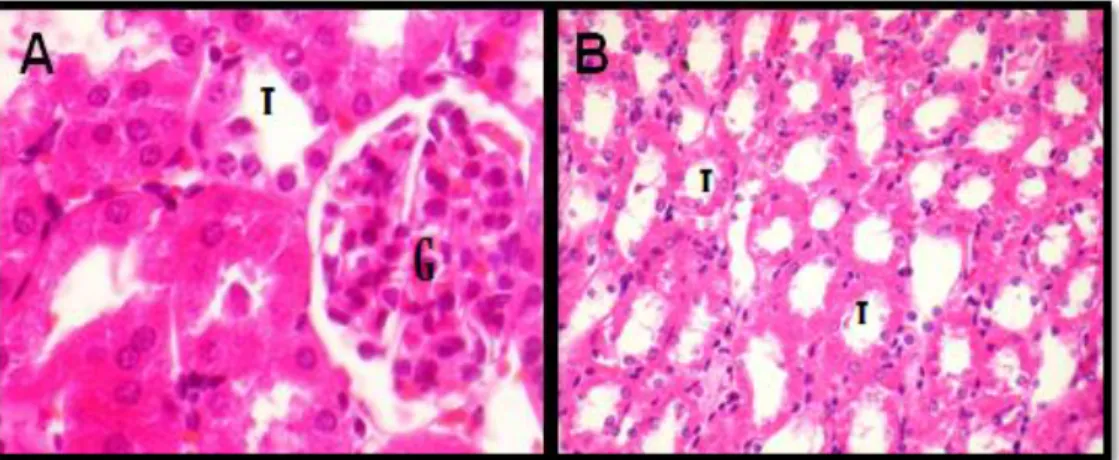 Figura  6:  Rim  de  ratinho  do  grupo  1  (controlo  negativo),  HE.  A  -Túbulos  renais  (T)  e  glomérulo renal (G) na zona cortical, 400x.B – Túbulos renais na zona medular (T), 400x 