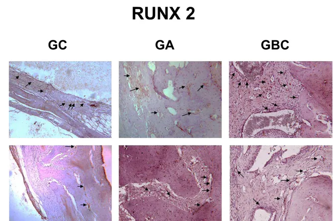 Figura 9  – Imunomarcação de RUNX 2 aos 14 dias para os grupos experimentais (GC: leve; GA: moderada; GBC: moderada)
