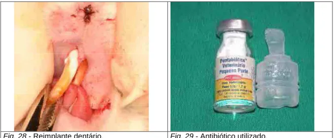 Fig. 28 - Reimplante dentário.  Fig. 29 - Antibiótico utilizado. 