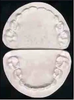 FIGURA 2 - Modelos de gesso dos arcos dentários decíduos 