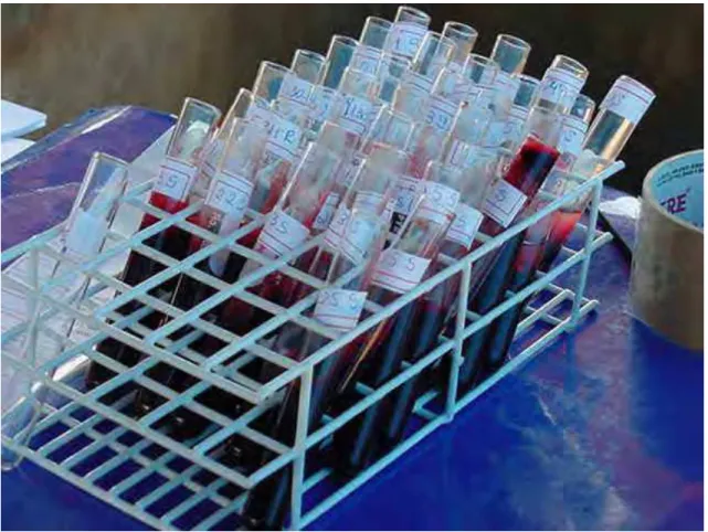 Figura 4 -  Amostras de sangue de suínos colhidas em tubos de vidro de 9ml. 