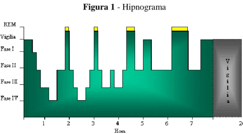 Figura 1 - Hipnograma   