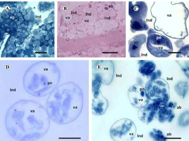 Fig. 3. Histological sections of salivary glands of semi-engorged females of Rhipicephalus sanguineus