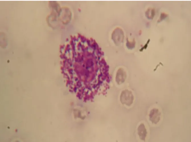 Figura 10: Imagem ecográfica do baço da Lusitânia.  Figura 11: Esfregaço da camada flogística da Lusitânia  (Diff Quik  TM , 100x)