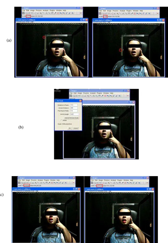 Figura  19  –    Processo  de  conversão  da  imagem  do  voluntário  em  estudo  de  pixel  para  milímetros     Fonte: (SILVA, 2013)