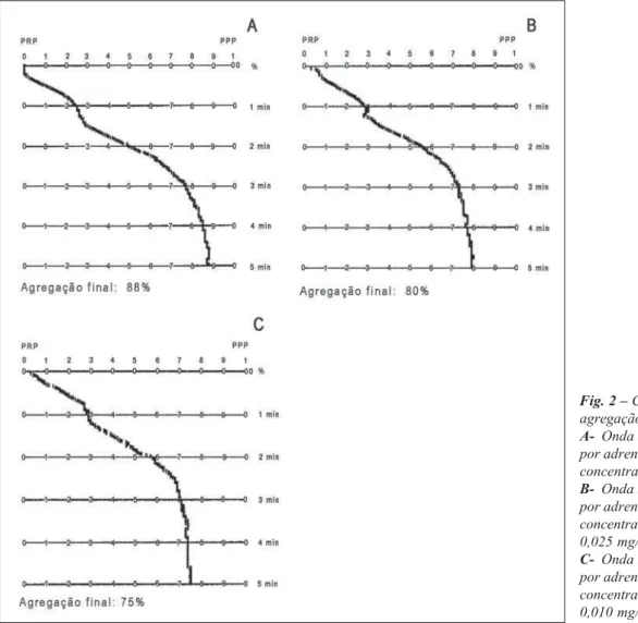 Fig. 2 – Curvas de agregação plaquetária A-  Onda bifásica induzida por adrenalina na