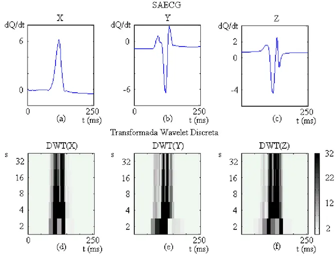 Figura 2.4: Três escalogramas DWT de um SAECG, análise diádica. 