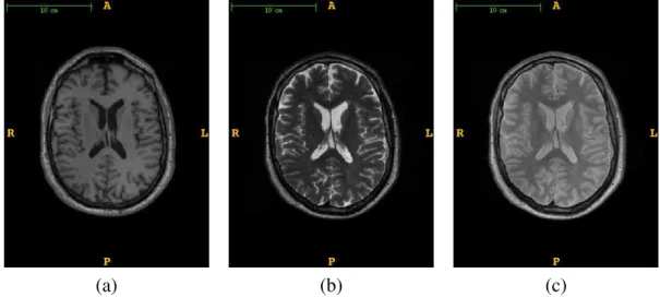 Figura 2.6: Comparação entre as ponderações (a) T1-w, (b) T2-w, e (c) PD-w na imagem de um mesmo paciente.
