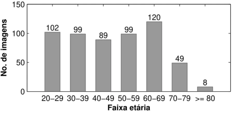 Figura 4.2: Distribuição etária dos pacientes nas imagens em T1-w da base de dados IXI.