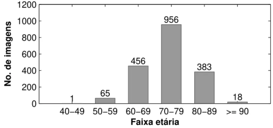 Figura 4.3: Distribuição etária dos pacientes nas imagens da base de dados ADNI.