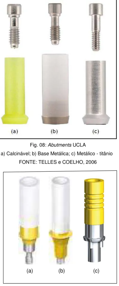 Fig. 08: Abutments UCLA  