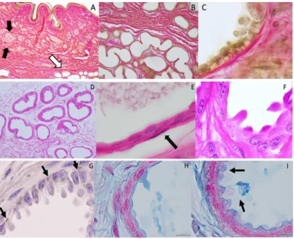 Figure 2. Histology-Bar = 100 µ m. Van Gieson’s Stain. (A) Organization of the inguinal sinus presenting sebaceous (black arrows) and acinar glandular fields (white arrow); (B) collagen fibers sustain the secretory epithelium of the acinar glands that pres