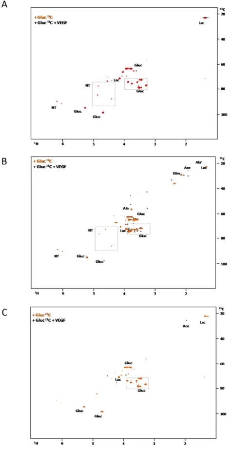 Figure 2: The effect of VEGF in glucose metabolism in AML cell lines. 1 H- 13 C-HSQC NMR spectra of HL60 (A), THP1 (B) and  HEL  (C)  intracellular extracts cultured with  13 C-U-glucose in the absence and in the presence of 10μg/mL of VEGF