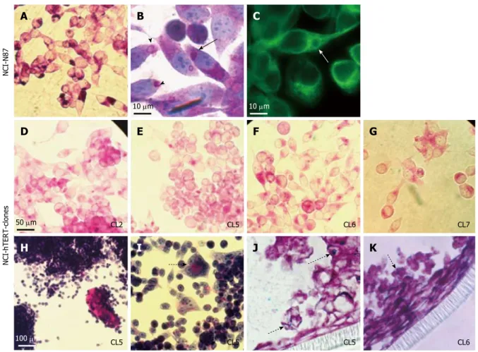 Figure 4  Evaluation of the expression of epithelial gastric markers by the  parental NCI-N87 and NCI-hTERT-clones 5 and 6 cell lines